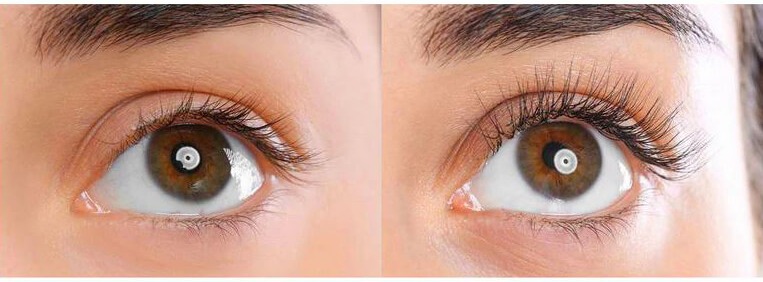 growth of eyelashes before after